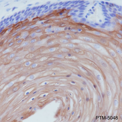 Anti-Keratin 10 Rabbit mAb