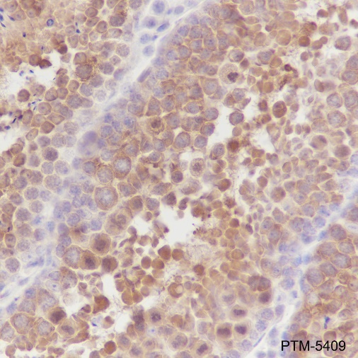 Anti-HSP90 alpha Mouse mAb