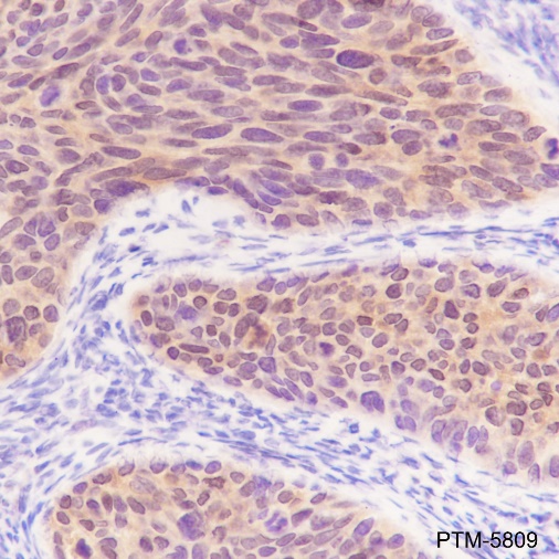 Anti-S100A2 Rabbit mAb