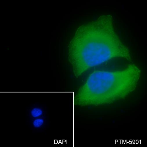 Anti-TPI1 Mouse mAb