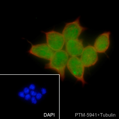 Anti-PHF20 Rabbit mAb
