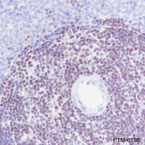 Anti-Ctip2/BCL11B Rabbit mAb