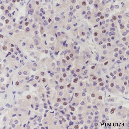 Anti-PITX2/RGS Rabbit mAb