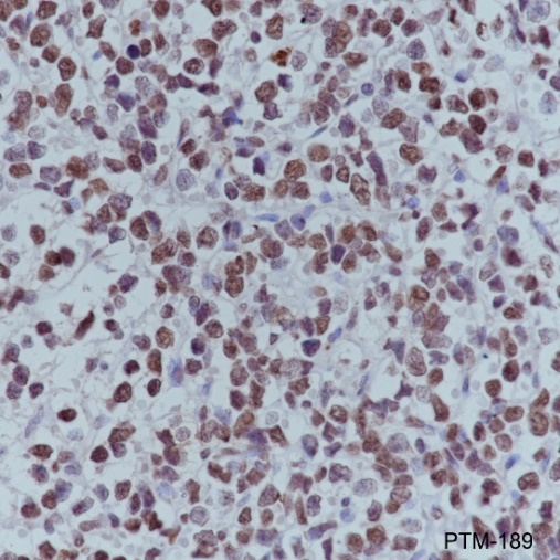 Anti-Acetyl-Histone H4 (Lys5/8/12/16) Mouse mAb