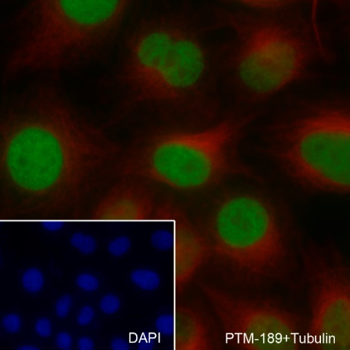 Anti-Acetyl-Histone H4 (Lys5/8/12/16) Mouse mAb