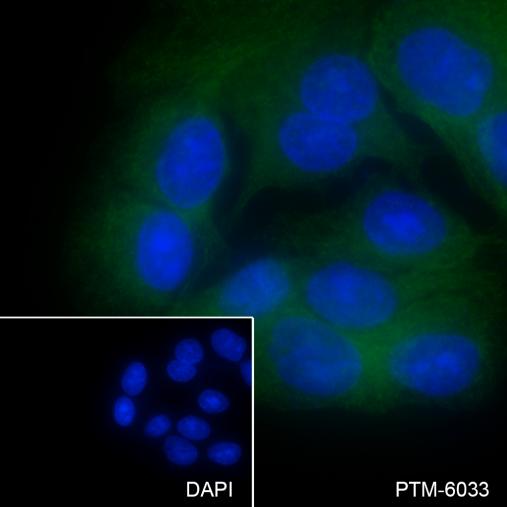 Anti-P4HA2 Mouse mAb