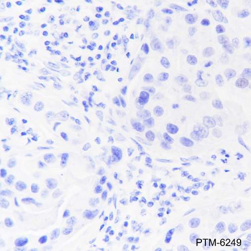Anti-PAP Rabbit mAb