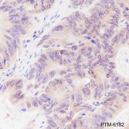 Anti-CNBP Mouse mAb