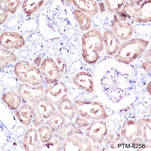 Anti-DOPA Decarboxylase / DDC Rabbit mAb