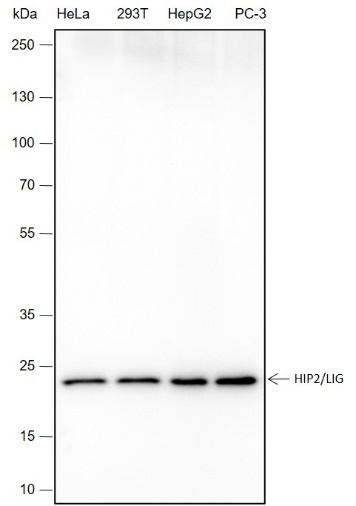 Anti-HIP2/LIG Rabbit mAb
