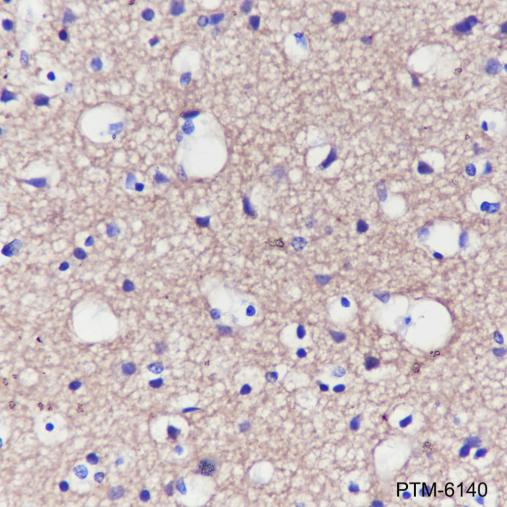 Anti-Dynamin 1 Mouse mAb