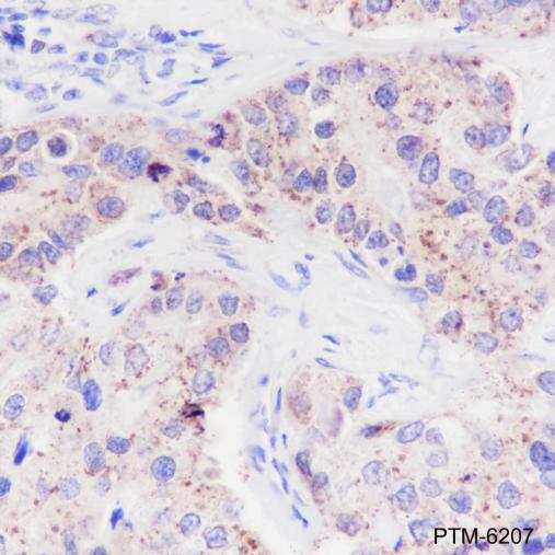 Anti-PYCR1 Mouse mAb