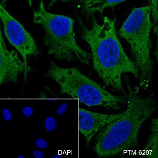 Anti-PYCR1 Mouse mAb