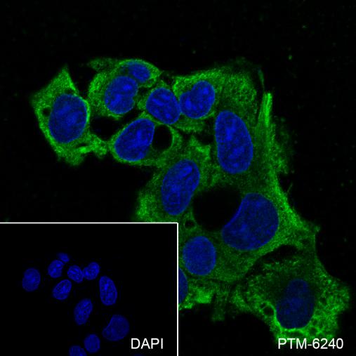 Anti-RBP4 Mouse mAb