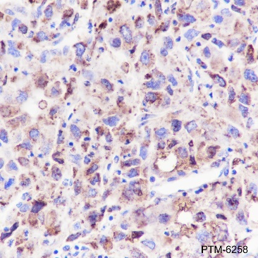 Anti-LDL Receptor Rabbit mAb