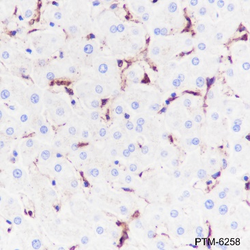 Anti-LDL Receptor Rabbit mAb