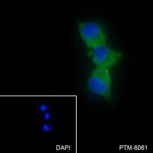 Anti-RIG-I/DDX58 Mouse mAb
