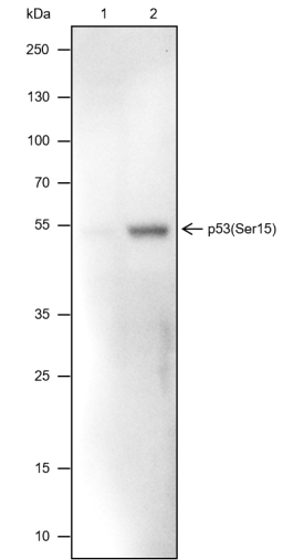 Anti-Phospho-p53 (Ser15) Mouse mAb
