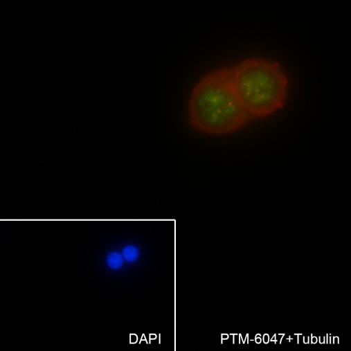 Anti-Phospho-p53 (Ser15) Mouse mAb
