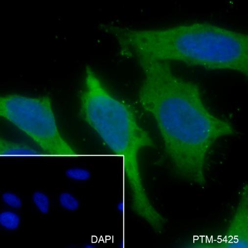 Anti-KRAS Mouse mAb