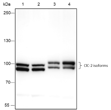 Anti-ClC-2 Rabbit mAb