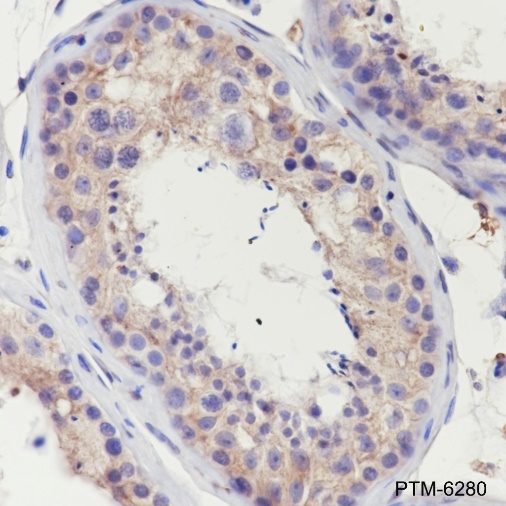 Anti-ClC-2 Rabbit mAb