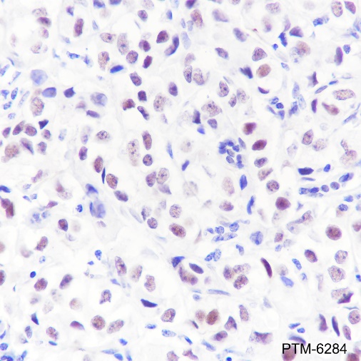 Anti-MED4 Rabbit mAb