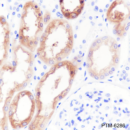 Anti-HGD Rabbit mAb