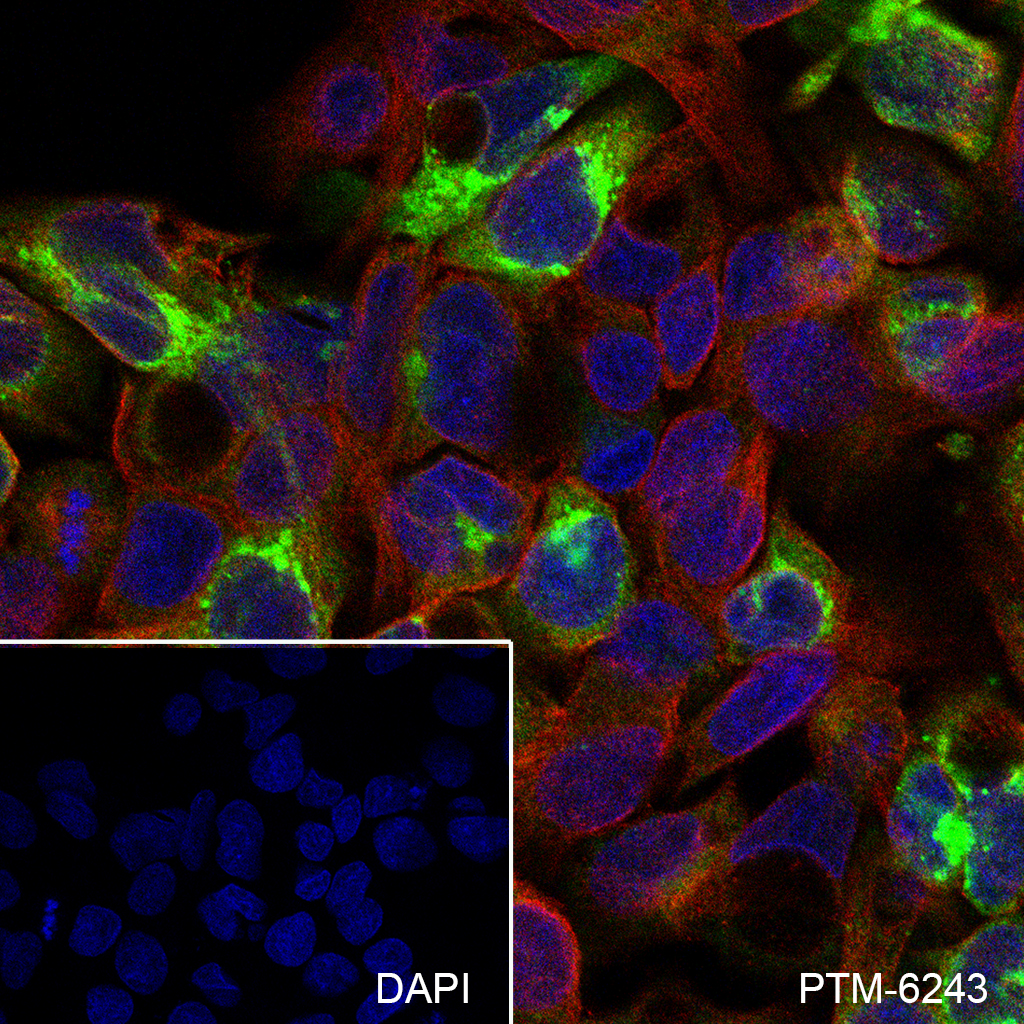 Anti-AFP Mouse mAb
