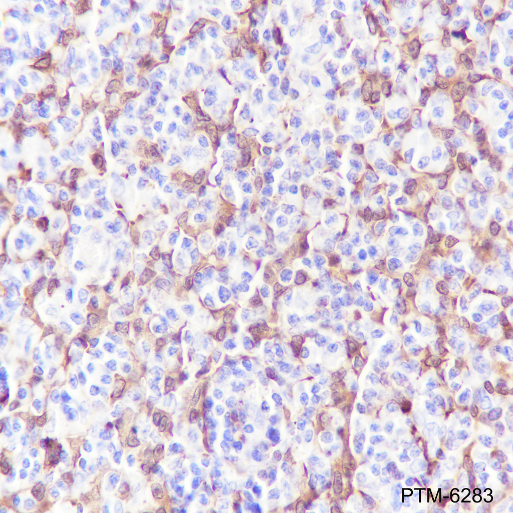 Anti-S100A8 Rabbit mAb
