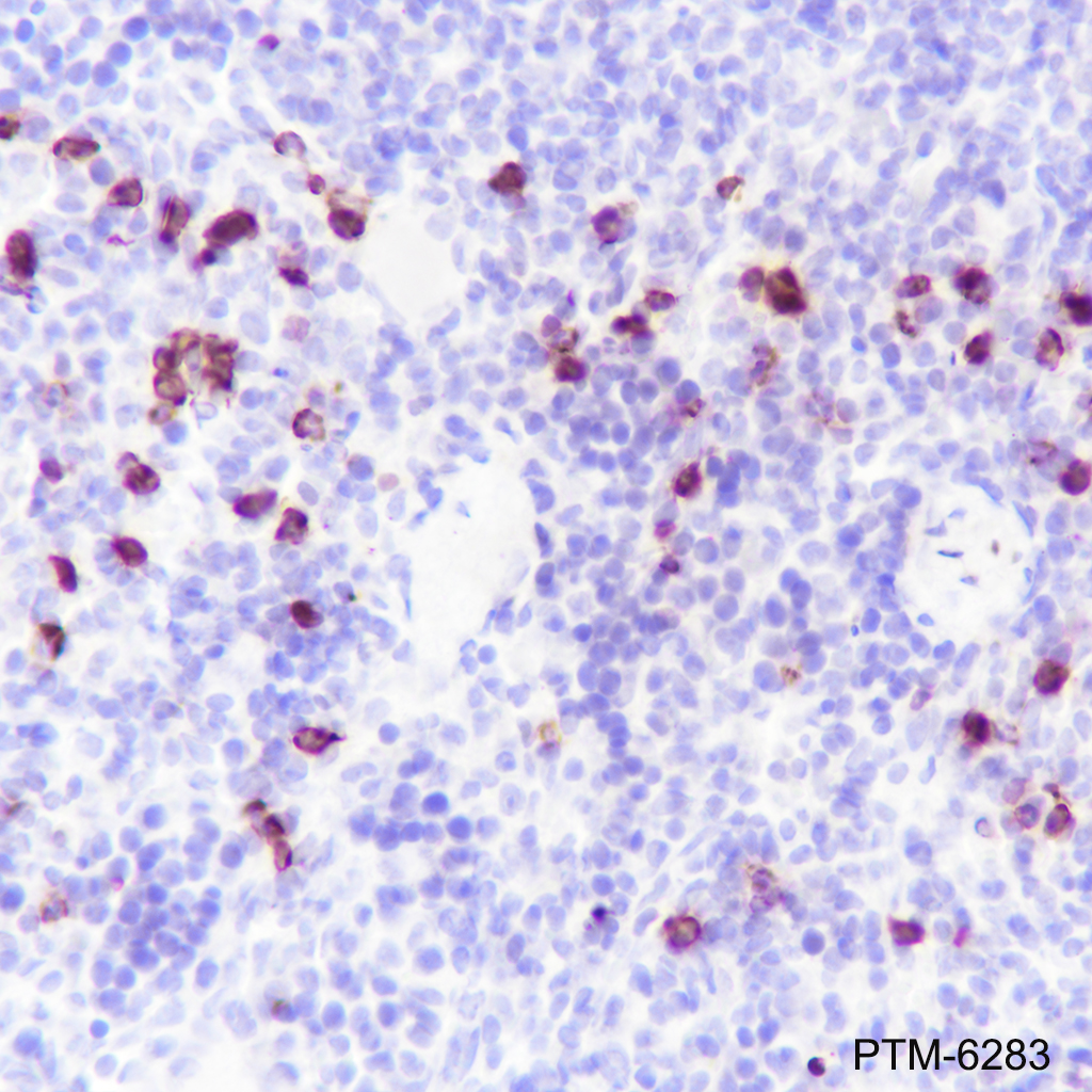 Anti-S100A8 Rabbit mAb