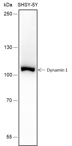 Anti-Dynamin 1 Rabbit mAb