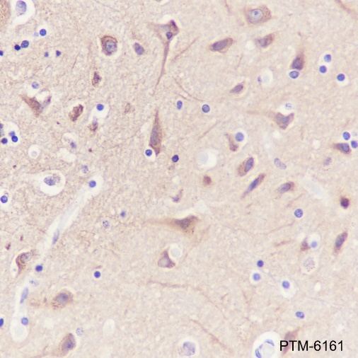 Anti-Dynamin 1 Rabbit mAb