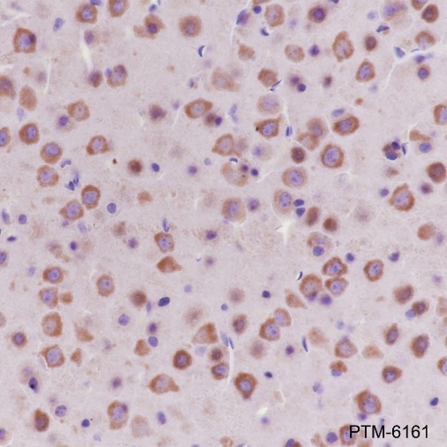 Anti-Dynamin 1 Rabbit mAb