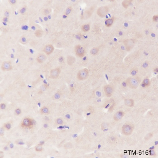 Anti-Dynamin 1 Rabbit mAb