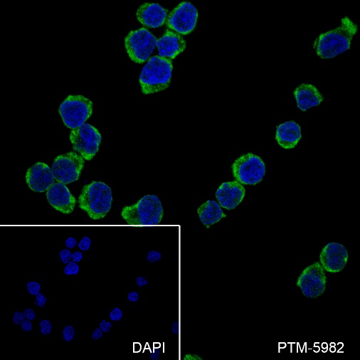 Anti-CD62L Rabbit mAb