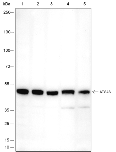 Anti-ATG4B Rabbit mAb