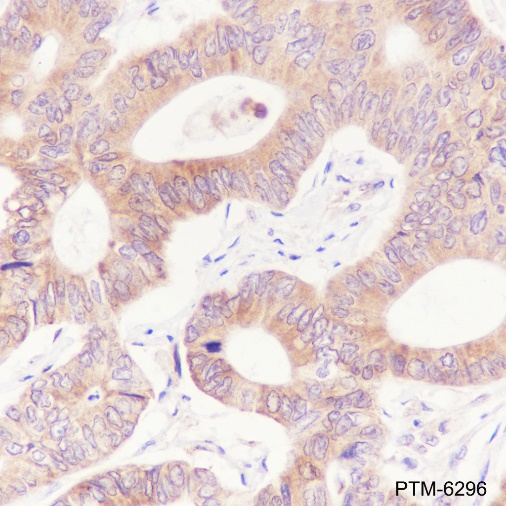Anti-ATG4B Rabbit mAb