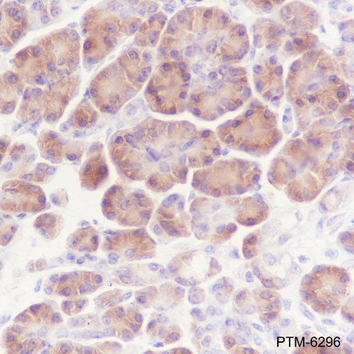 Anti-ATG4B Rabbit mAb