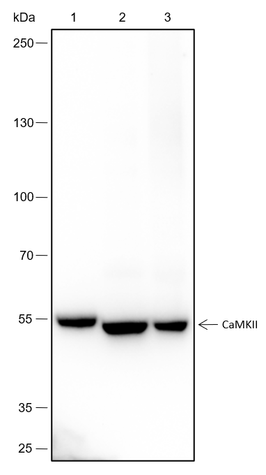Anti-CaMKII alpha Rabbit mAb