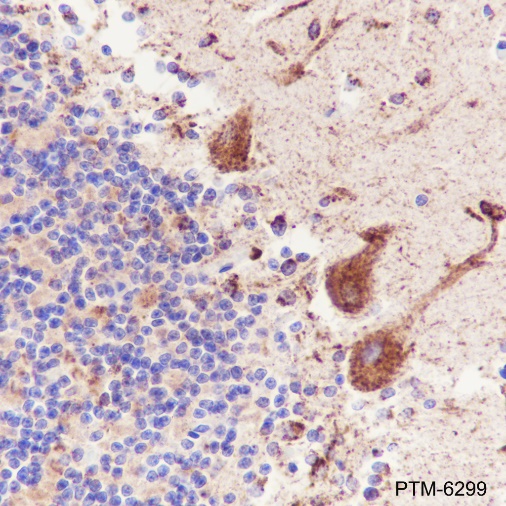 Anti-CaMKII alpha Rabbit mAb