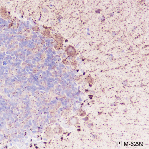 Anti-CaMKII alpha Rabbit mAb