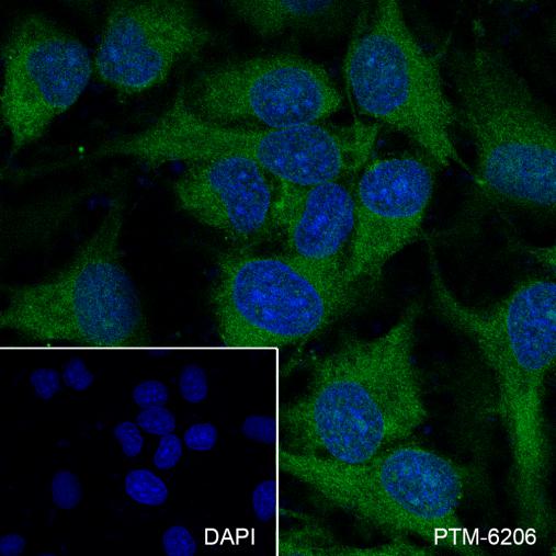 Anti-PKC delta Rabbit mAb
