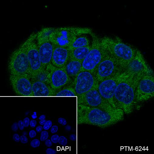 Anti-Lactoferrin Mouse mAb