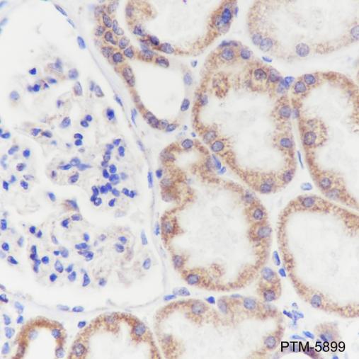 Anti-NDUFB8 Mouse mAb