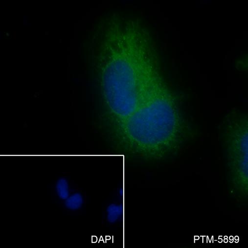 Anti-NDUFB8 Mouse mAb