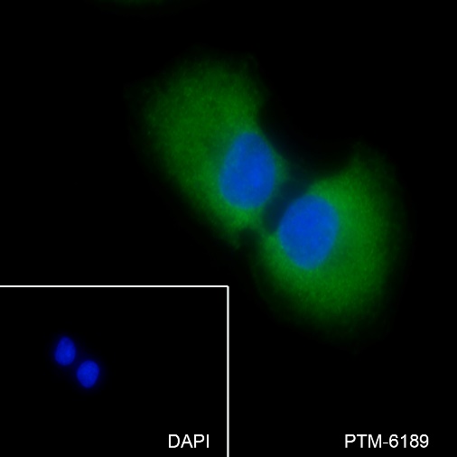 Anti-Vitronectin/S-Protein Rabbit mAb