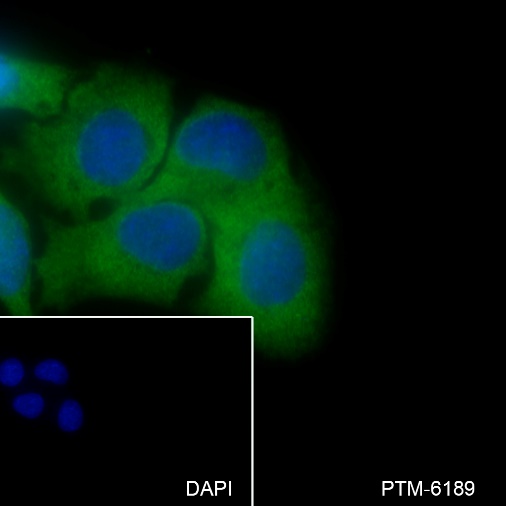 Anti-Vitronectin/S-Protein Rabbit mAb
