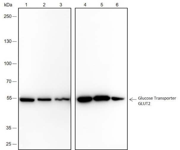 Anti-GLUT2 Rabbit mAb
