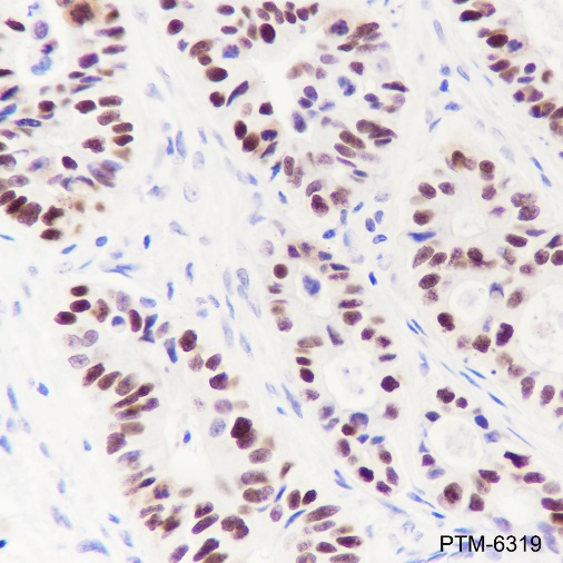 Anti-p53 Rabbit mAb